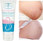 Stretch Marks Fading Cream Maternity Scars Acne Cream Pregnancy Stretch Marks Remove Cream Repair Anti-Aging Winkle Firmng Body Cream (3 PCS)