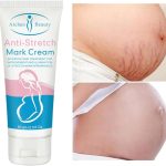 Stretch Marks Fading Cream Maternity Scars Acne Cream Pregnancy Stretch Marks Remove Cream Repair Anti-Aging Winkle Firmng Body Cream (3 PCS)