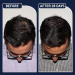 FEGPLUS Hair & Beard Growth Serum - Image 2