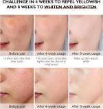 Alpha Arbutin Whitening Serum Visibly Fades and Reduces Skin Discollation Associated from Dark Spots Sun Spots Acne Scars - Image 5