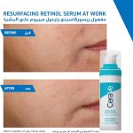 CERAVE RESURFACING RETINOL SERUM TO REDUCE THE APPEARANCE OF POST-ACNE MARKS AND PORES WITH RETINOL - Image 5