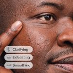 The Ordinary Salicylic Acid 2% Solution, Acne-Fighting Serum for Blemish-Prone Skin - Image 2