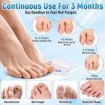 Nail Fungus Laser Treatment Device, Effective and Rechargeable Fungus Remover